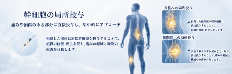 膝や股関節など患部へ幹細胞を直接投与する局所注射療法のイメージ