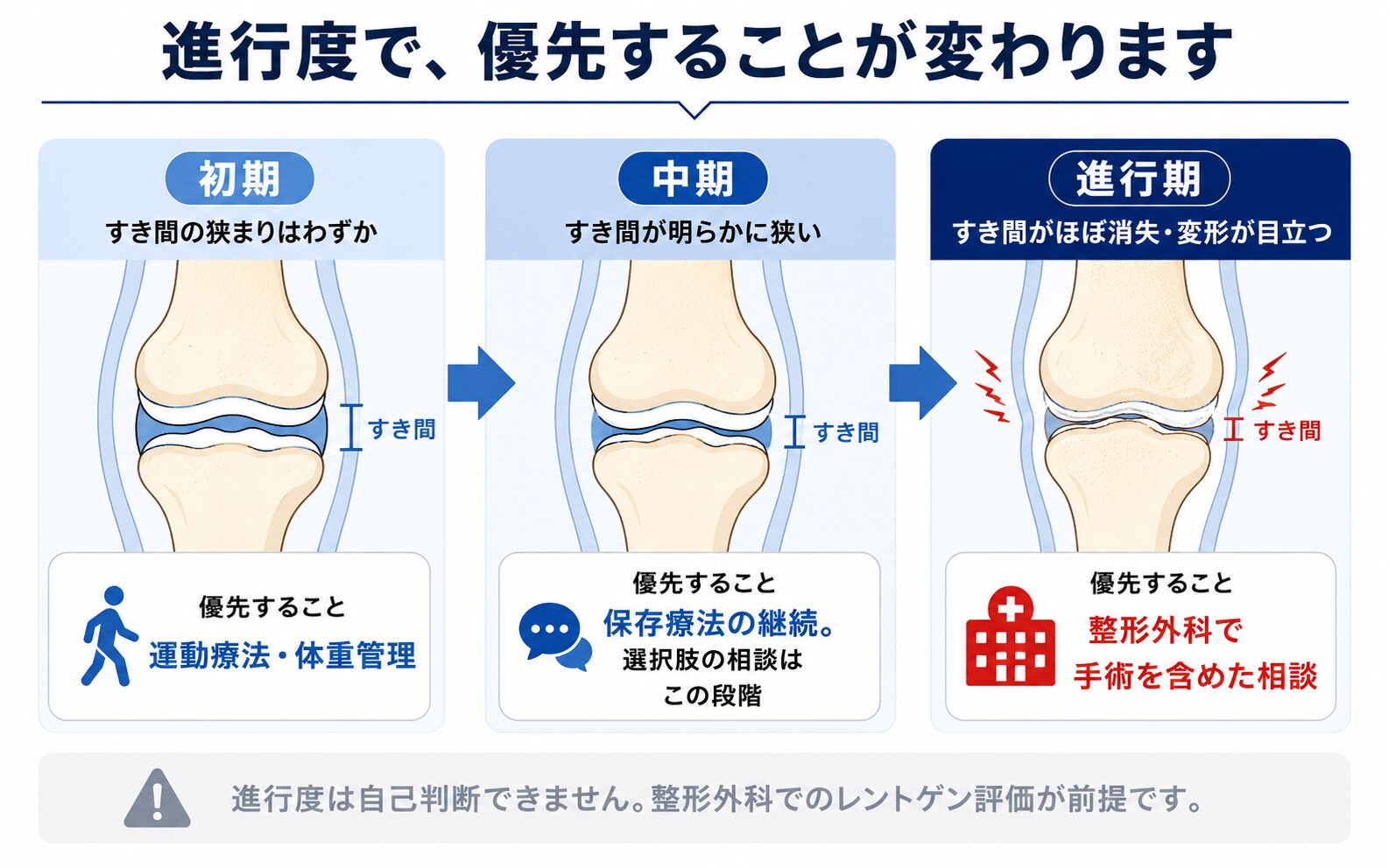 変形性膝関節症の進行度(KL分類1〜4)と、それぞれの段階で優先される対応を示した図解