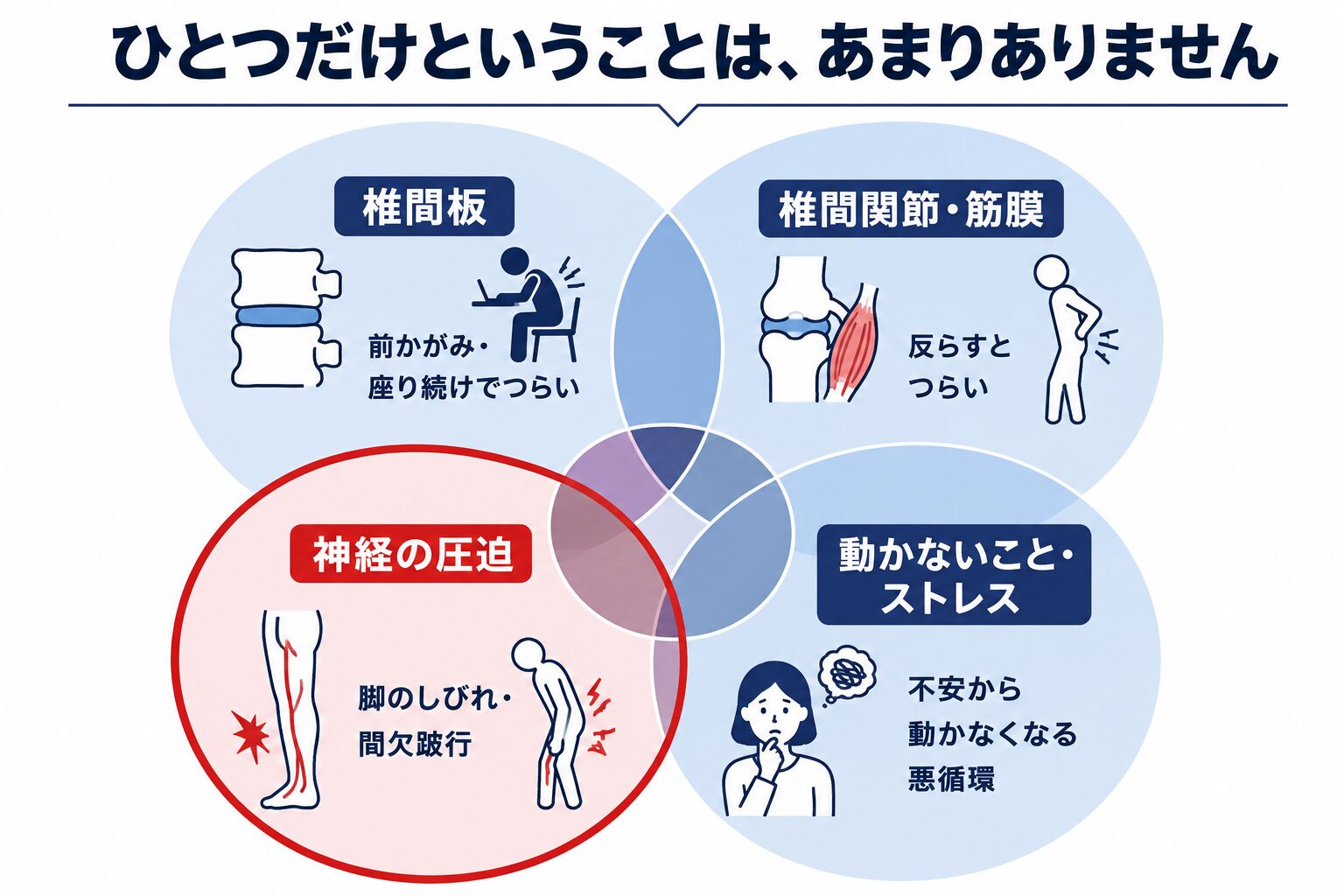 腰痛に関わる4つの要素（椎間板・椎間関節や筋膜・神経の圧迫・動かないことやストレス）を分けて示した図解