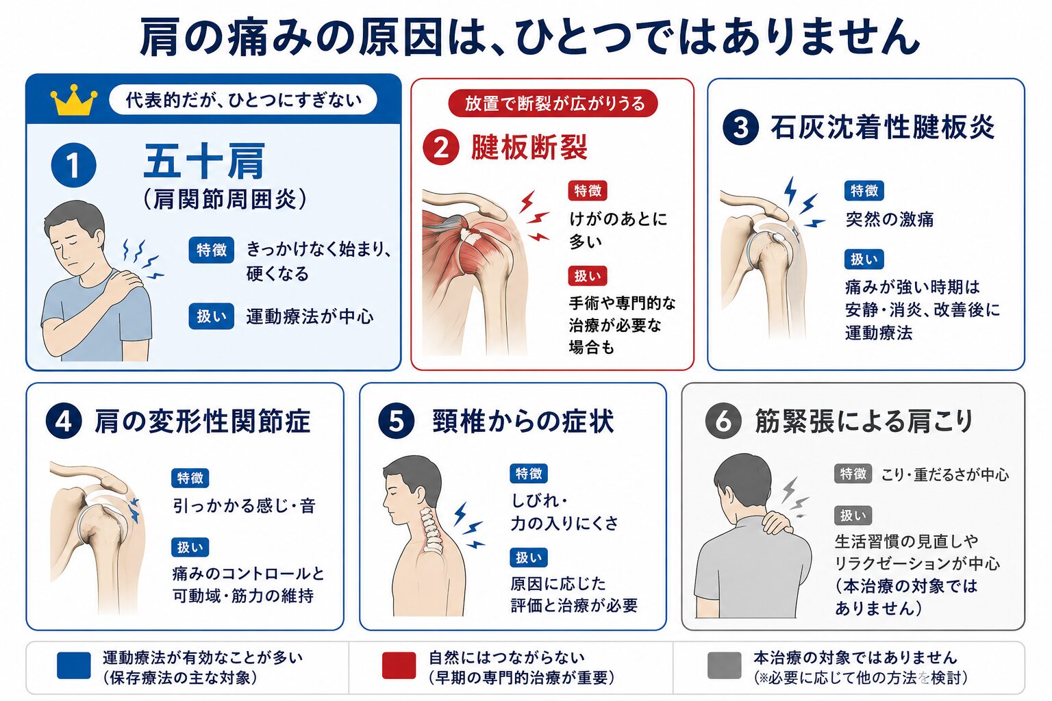 肩の痛みの主な原因(五十肩・腱板断裂・石灰沈着性腱板炎・肩の変形性関節症・頸椎からの症状・筋緊張による肩こり)を分類して整理した図解